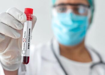 Laboratório Paulista oferece exame para diagnóstico da varíola dos macacos