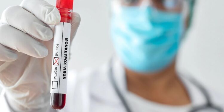 Laboratório Paulista oferece exame para diagnóstico da varíola dos macacos