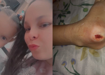 A mãe Ingrid fez uma vaquinha para custear o tratamento da filha Rebeca. (Arquivo Pessoal)