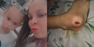 A mãe Ingrid fez uma vaquinha para custear o tratamento da filha Rebeca. (Arquivo Pessoal)