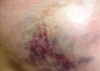 O investigado ainda arrastou a senhora pelo chão e fugiu com o comparsa levando cartões, dinheiro e o aparelho celular. (Divulgação/Polícia Civil)