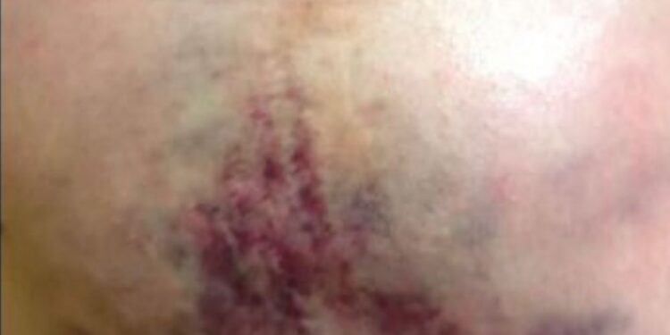 O investigado ainda arrastou a senhora pelo chão e fugiu com o comparsa levando cartões, dinheiro e o aparelho celular. (Divulgação/Polícia Civil)