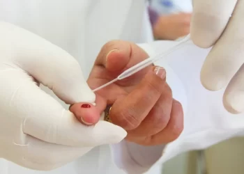 Nos locais serão realizados testes rápidos para HIV, Sífilis e Hepatites B e C. O resultado sai na hora, em aproximadamente 15 minutos. (Divulgação)