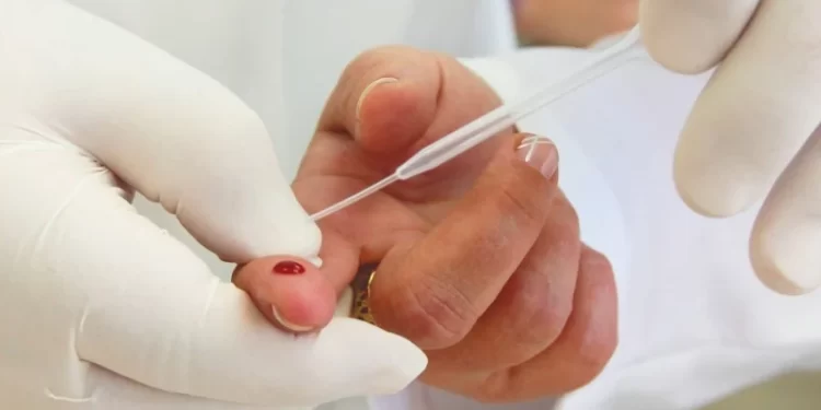Nos locais serão realizados testes rápidos para HIV, Sífilis e Hepatites B e C. O resultado sai na hora, em aproximadamente 15 minutos. (Divulgação)