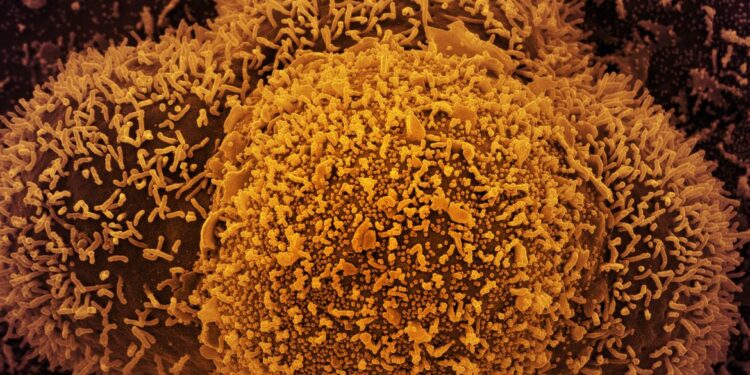 Além do Brasil, a subvariante JN 2.5 também foi identificada no Canadá, na França, na Polônia, na Espanha, nos Estados Unidos, na Suécia e no Reino Unido.