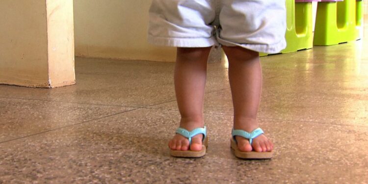 Acidentes matam diariamente 12 crianças e hospitalizam 335, em média, no Brasil, segundo a Organização Não Governamental (ONG) Criança Segura. (TV Brasil)