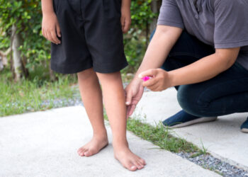 É importante ter atenção ao uso correto dos repelentes.