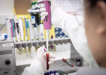 No estado de São Paulo, casos suspeitos de ebola devem ser comunicados imediatamente à vigilância epidemiológica municipal e ao Centro de Vigilância Epidemiológica do Estado de São Paulo (CVE-SP)
